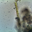 diatomée02 x400