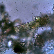 diatomée05 x400 colonie