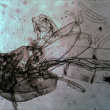 La cuticule d une larve d Insecte X40