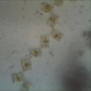 algues obj x40